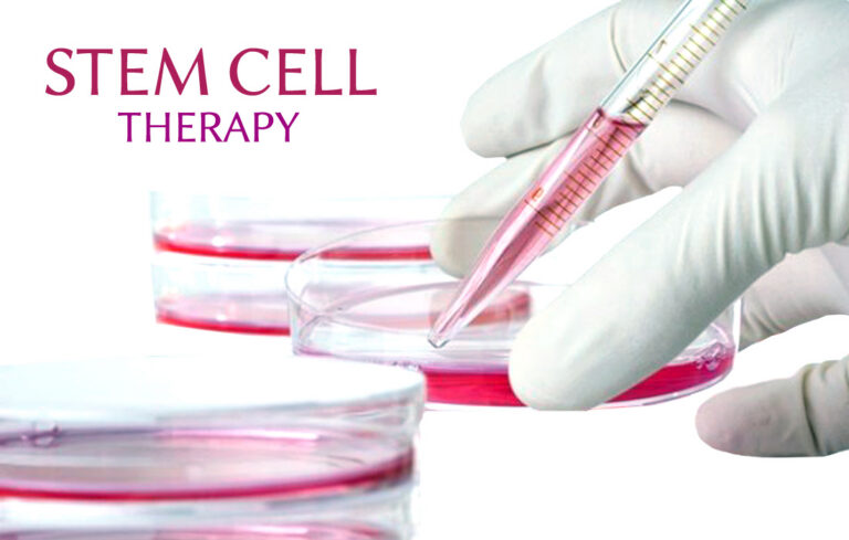 Stem Cell Therapy Plans: The Definitive 2026 Editorial Reference